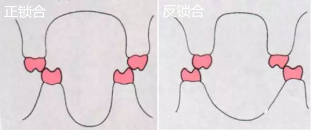 你的牙没缺没烂就是嚼不动有可能是后牙锁合在搞事情