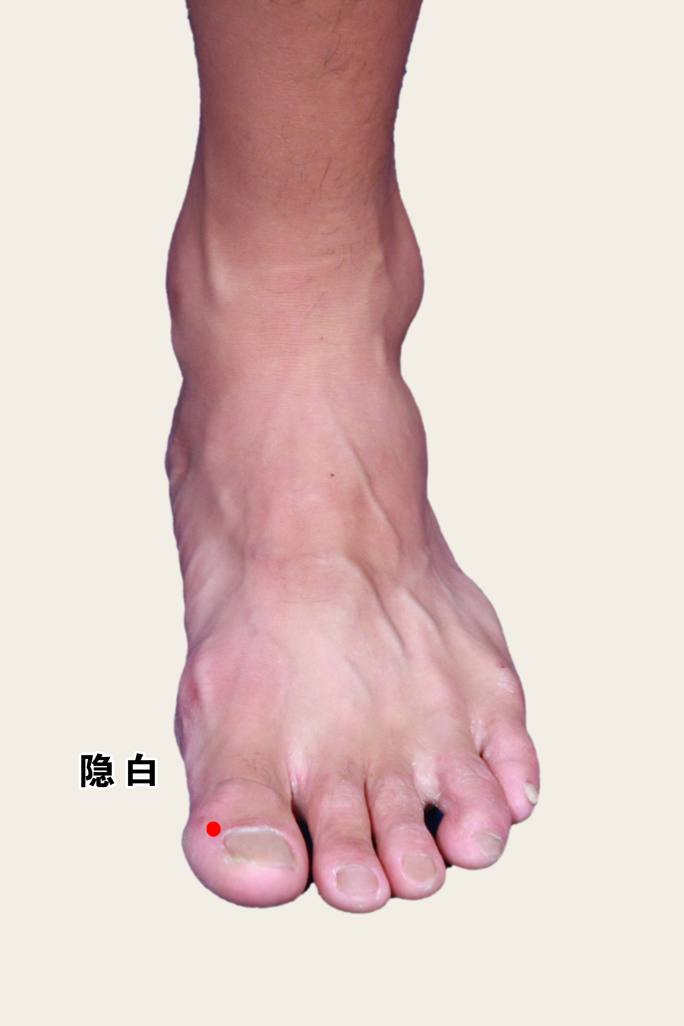 程博士每天教你一招经络排毒~隐白_程凯_主任医师_爱问健康