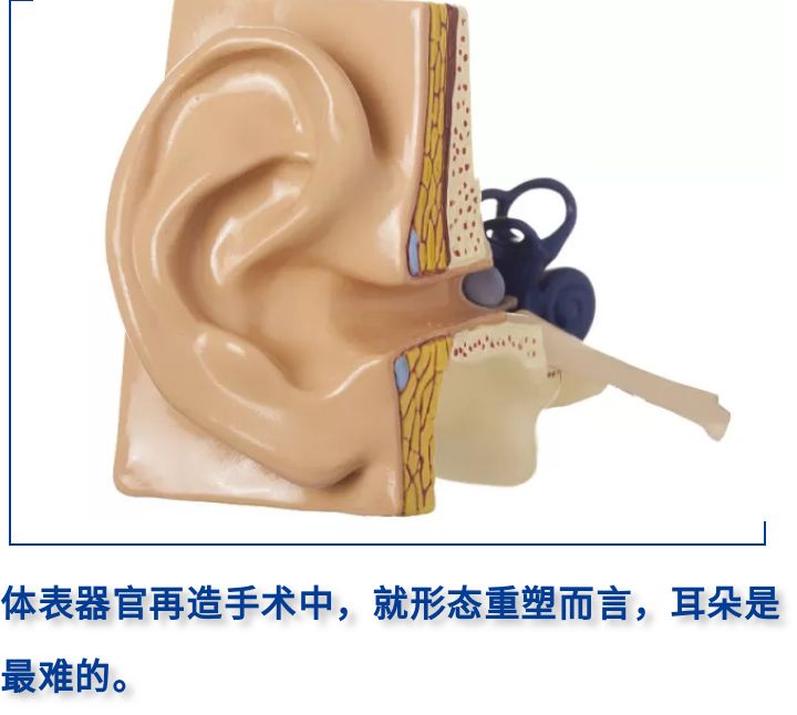 小耳症那些事儿(二十四)再造耳朵的相似度