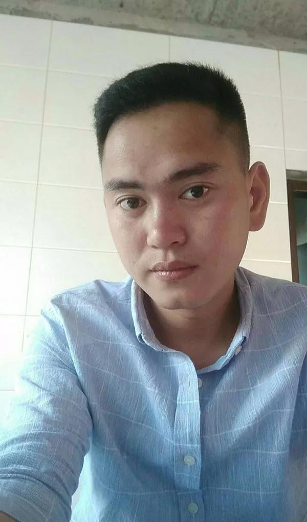 脱发自卑怕照相,植发3750单位变帅迷上自拍!