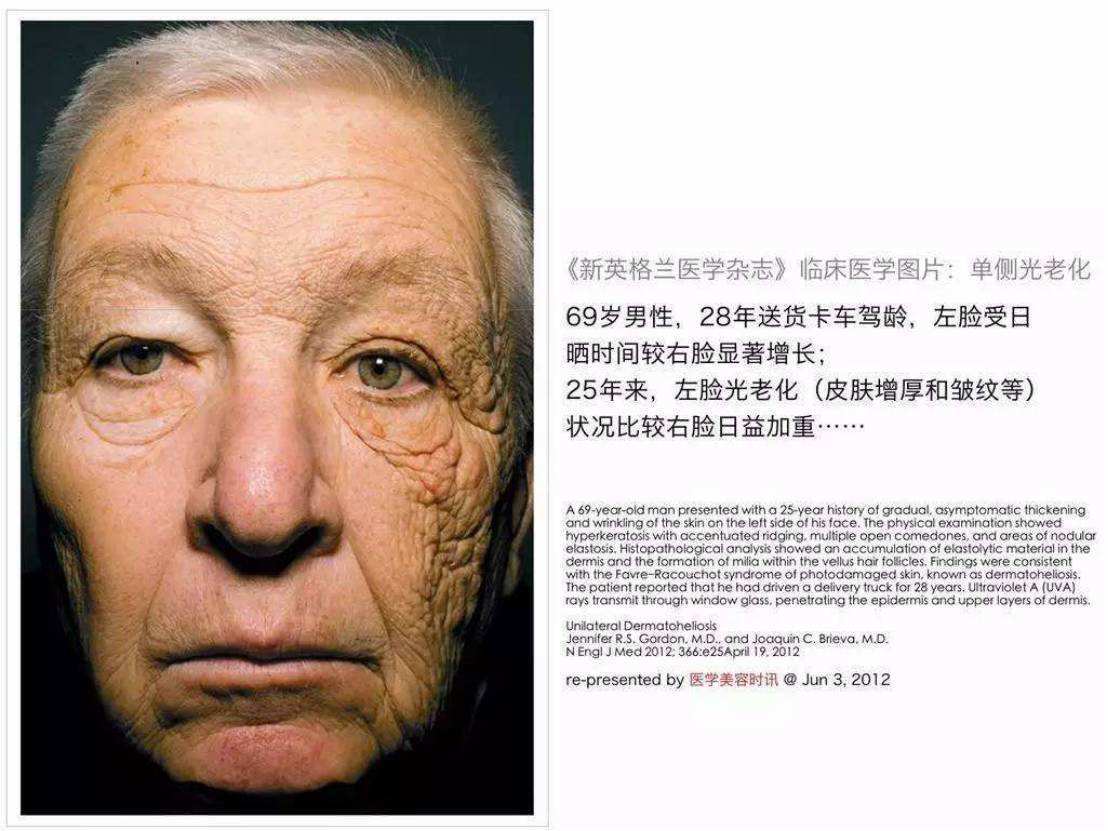 科学对抗面容衰老要从三个方面入手_张宗学__爱问健康