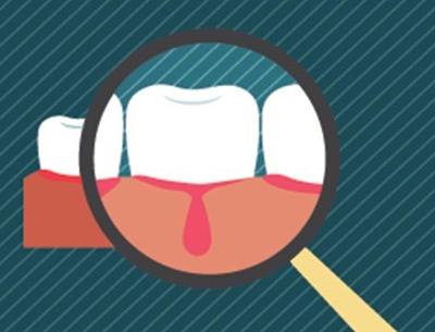 为什么你的牙龈经常会出血