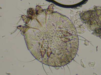 疥虫显微镜下形态治疗方法:①盐酸奥洛他定片口服,每日一次,每次2片