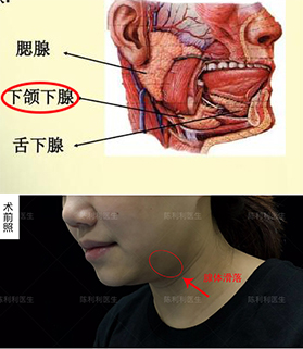 病因及解决方案