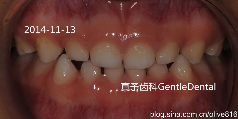 斜导照片图片