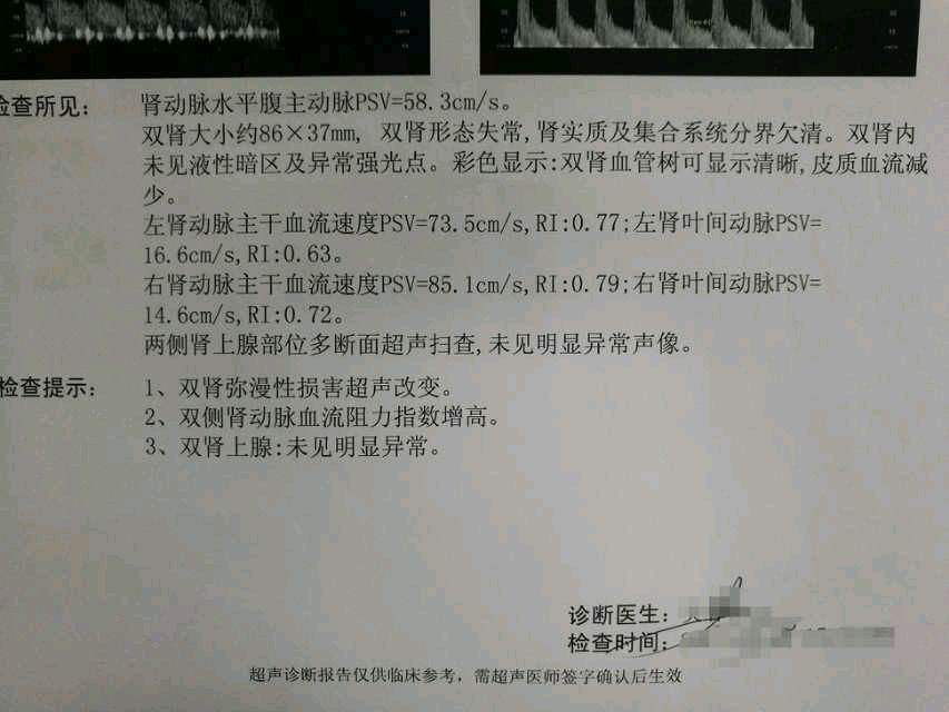 图一（注：这是来自一位慢性肾衰竭病人的彩超检查，提示双肾已经萎缩）2