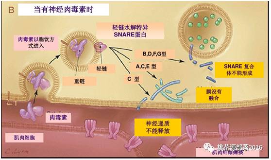 从基础到临床—3种a型肉毒杆菌毒素产品的比较_钱辉_主治医师_爱问