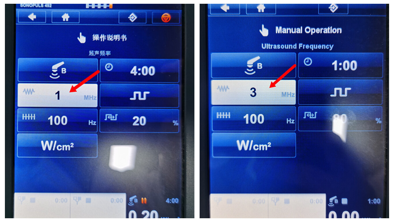 超声波治疗是什么“简单”解读超声波理疗_https://www.jmylbn.com_新闻资讯_第6张