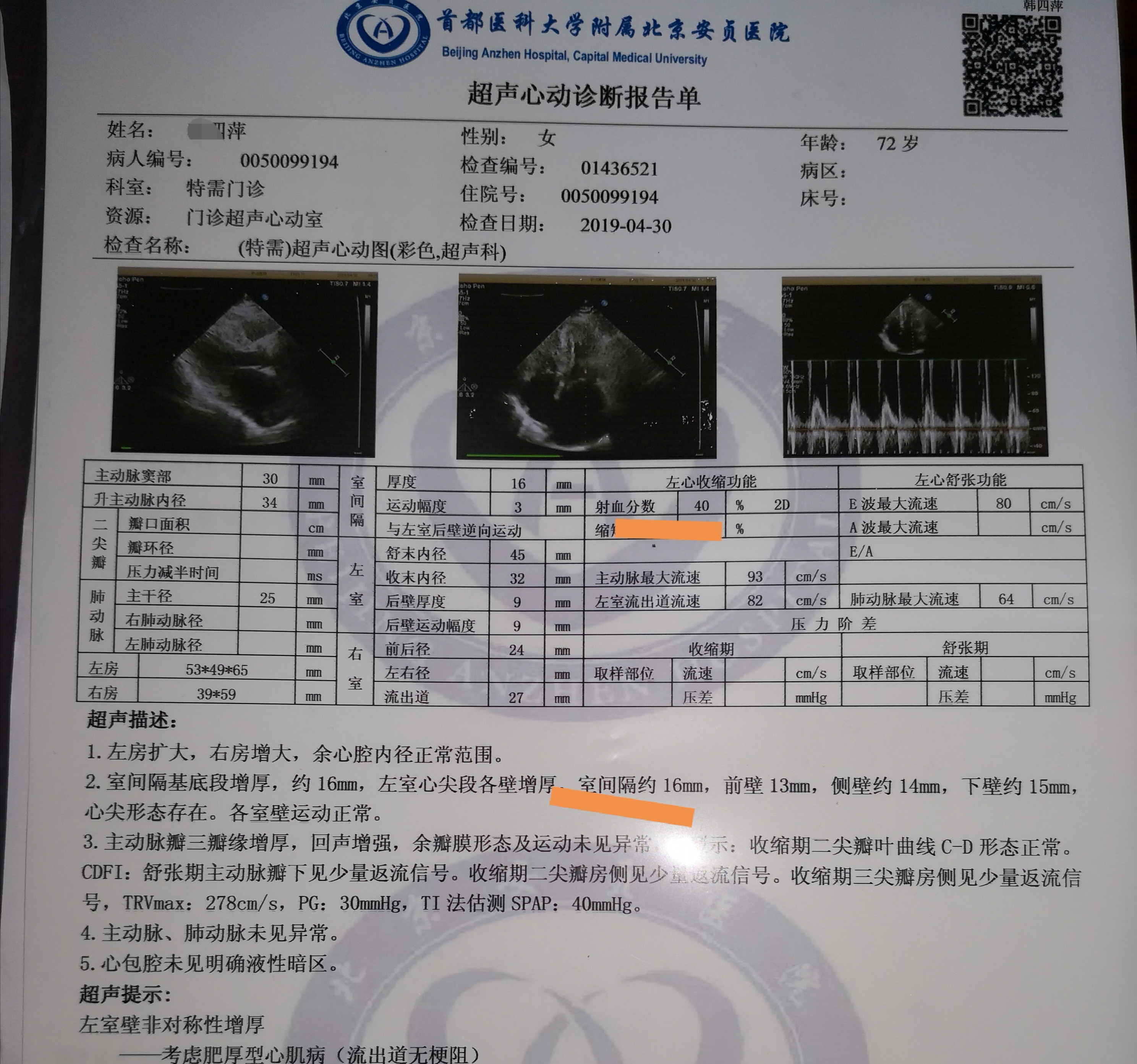 马宝琳:左房大可以逆转吗?_马宝琳_住院医师_爱问健康