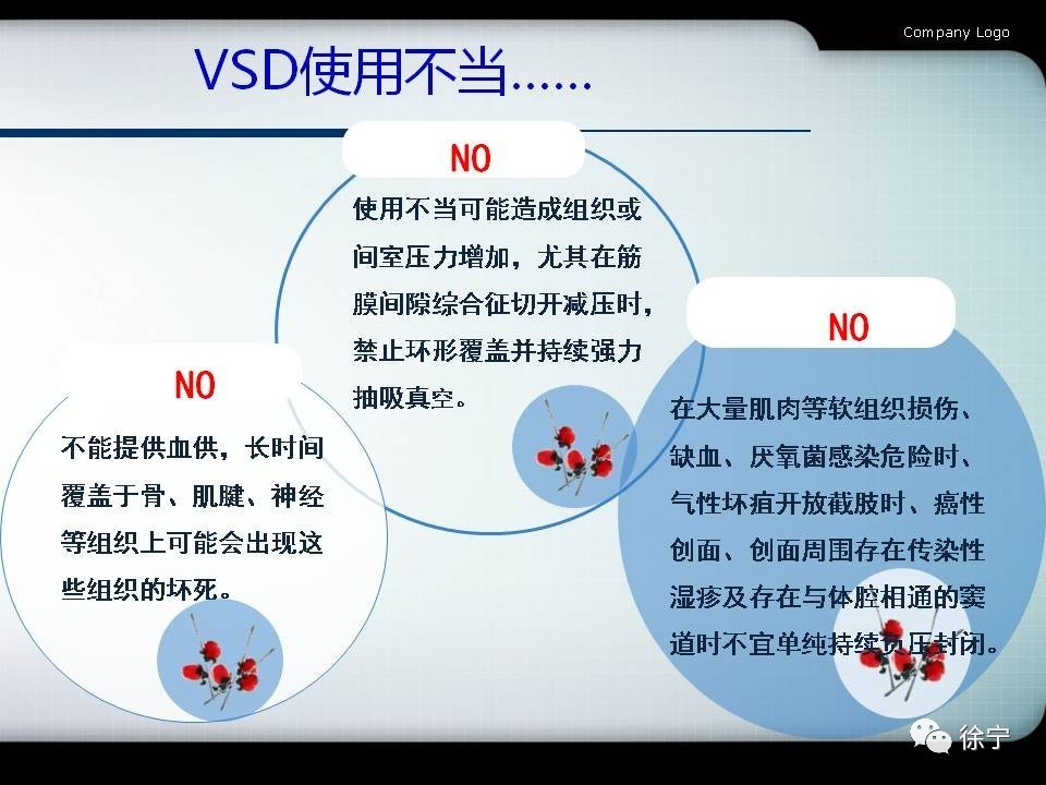 为什么负压引流​负压封闭引流技术VSD_https://www.jmylbn.com_新闻资讯_第10张