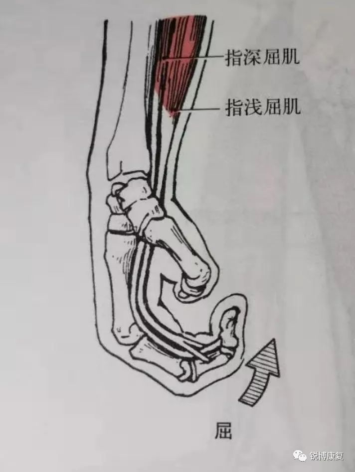 涉及萎缩的肌肉包括腕部和手指屈肌肌群——小贴士:·手部正中神经