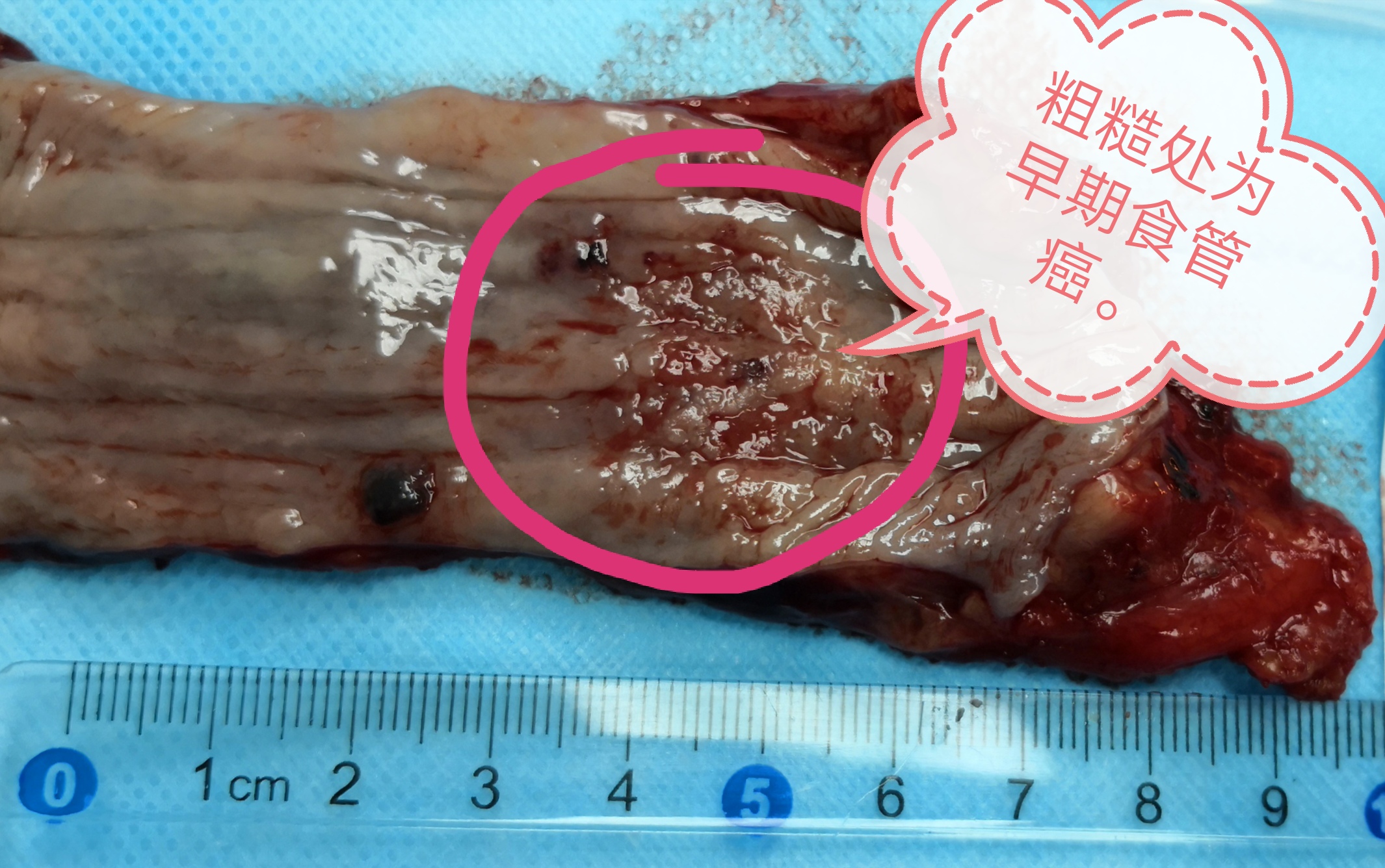 环卫工人打死了老虎!_王继勇_主任医师_爱问健康