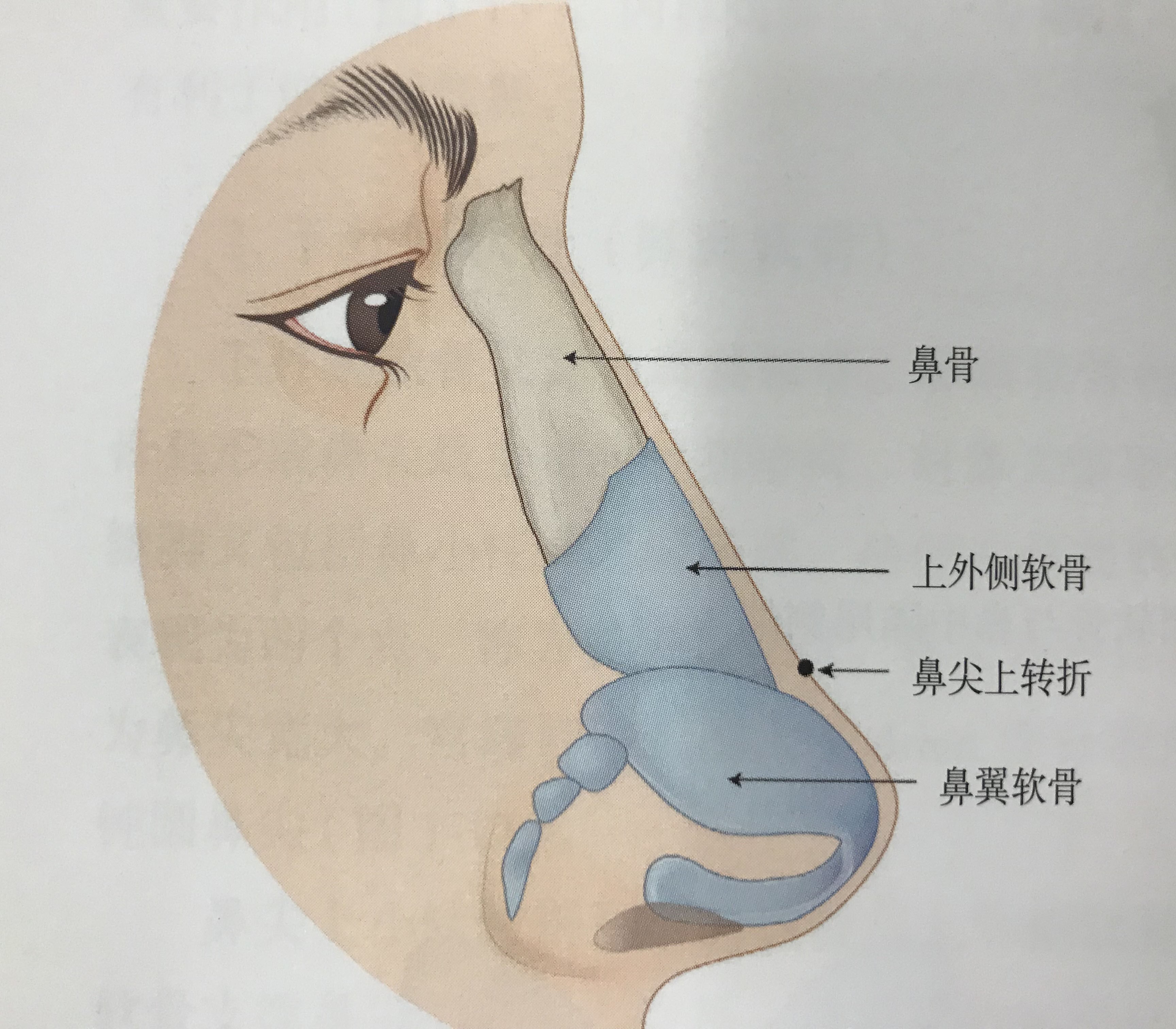 侧面挺翘正面塌的“塌鼻子”你知道是怎么回事吗？_宫风勇_副主任医师_爱问健康