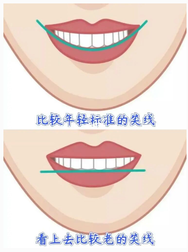 牙齿矫正，如何调整微笑线 _刘明星_主治医师_爱问健康