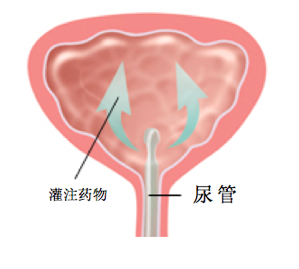 屏幕快照 2017-11-19 下午11.15.55.png