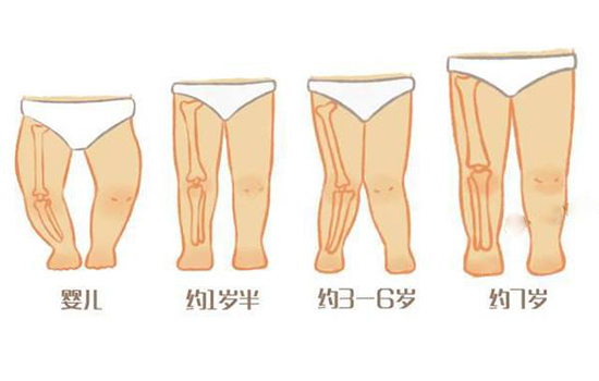 婴儿腿型发育标准图片图片