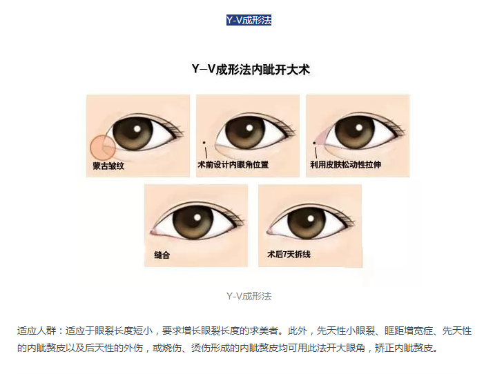 1-16101311292BB.png