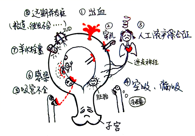 欧美偏好口服避孕药,我们偏好人流?_舒畅_主治医师_爱问健康