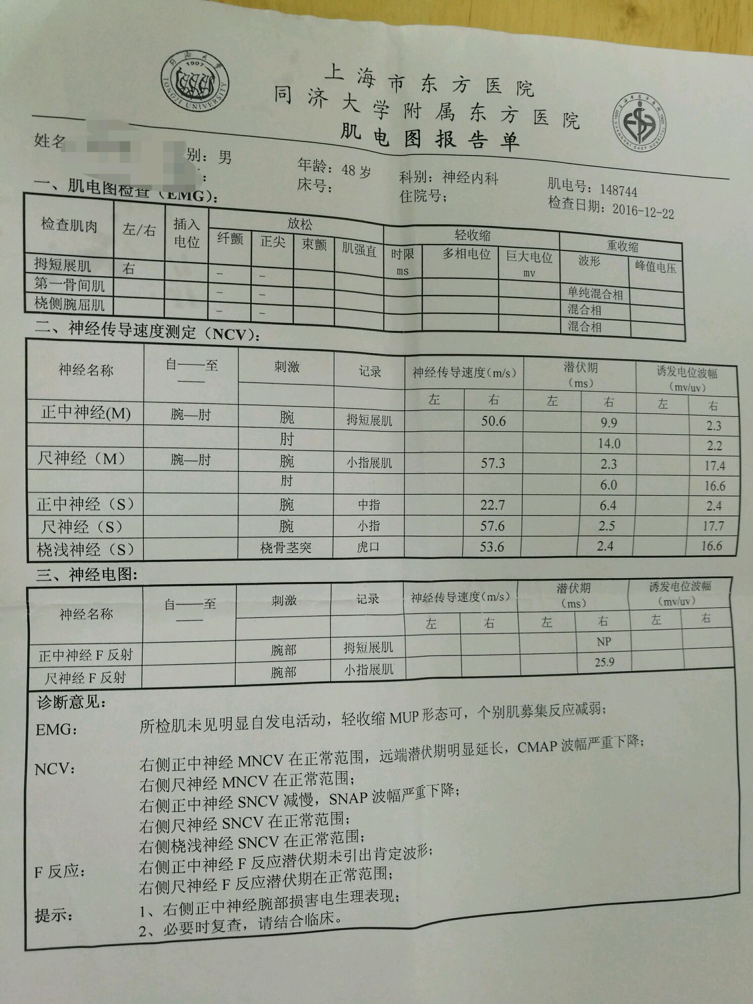 腕管综合征