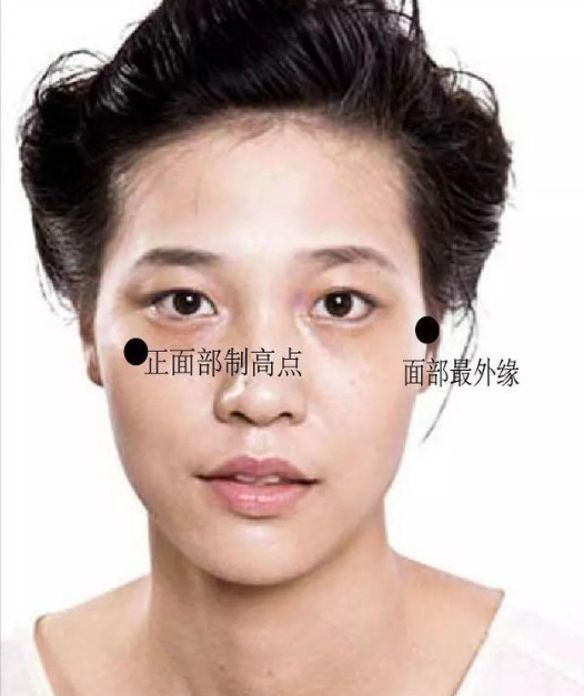 美人在骨 不在皮,颧骨颧弓剖析_何晋龙_副主任医师_爱问健康
