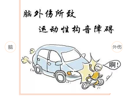 运动性构音障碍:是由于神经病变导致言语肌肉的麻痹或运动不协调酥侣