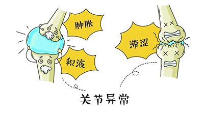 类风湿关节内的表现(下)