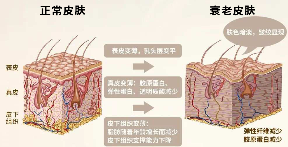 皮肤衰老过程示意图图片