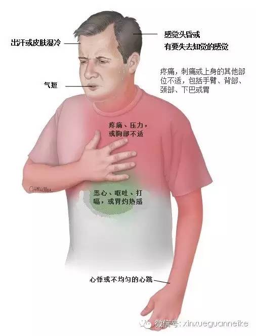 于泓医生:发生胸痛时怎么办?