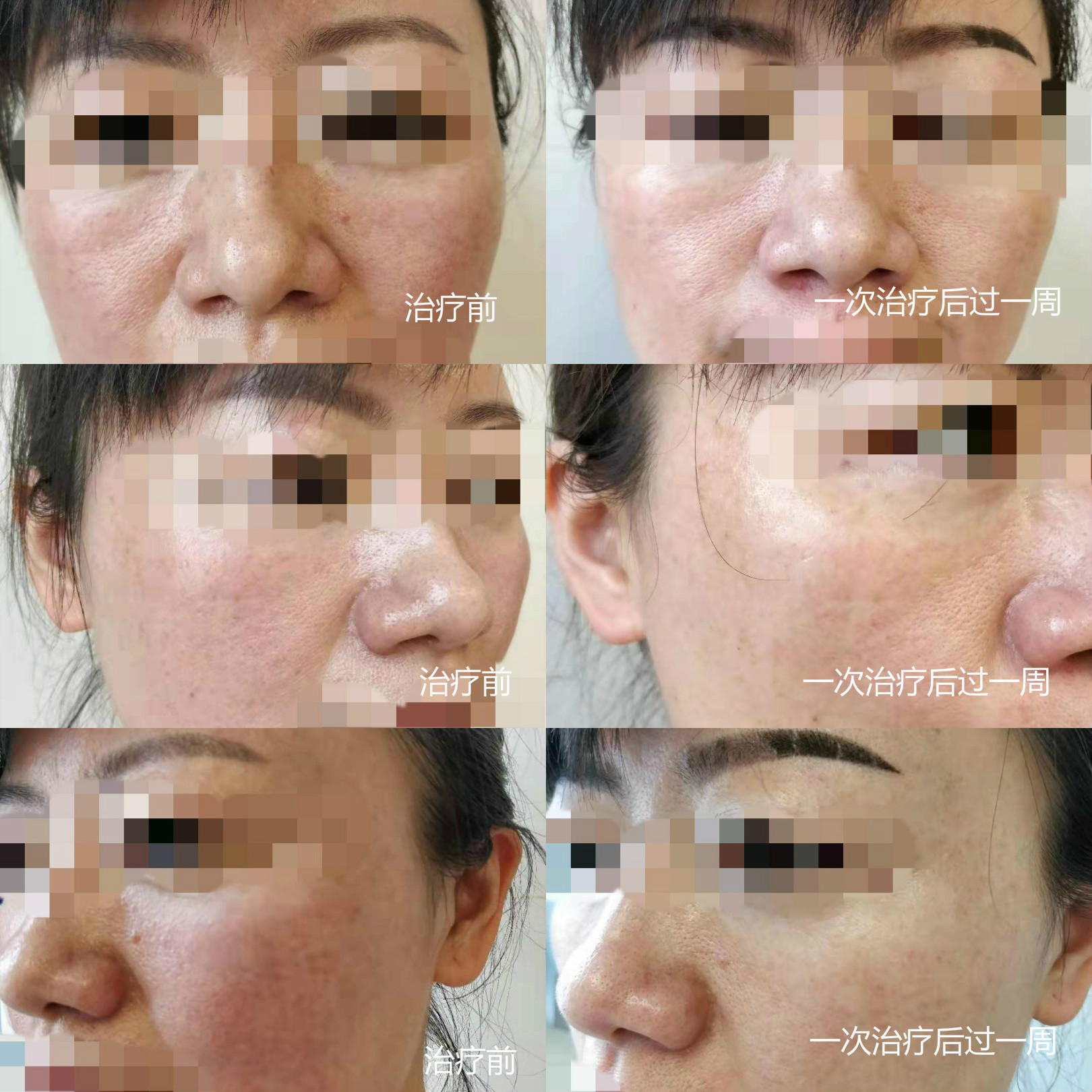 舒敏之星/敏感肌肤解决方案_朱敏刚_主任医师_爱问健康