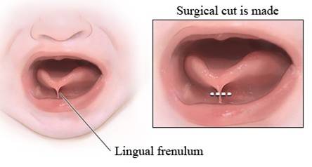 Frenulum.jpg