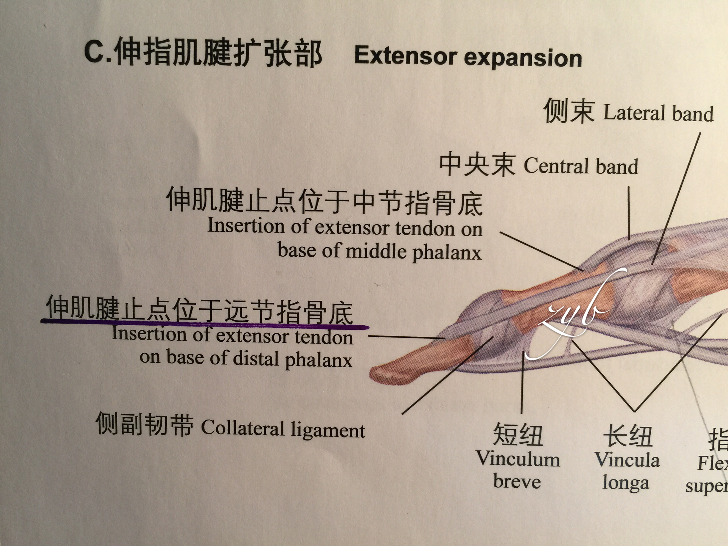 伸指肌腱解剖图片