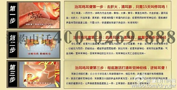 8d07cc20gw1f1wm9ydee3j20r30duaea.jpg