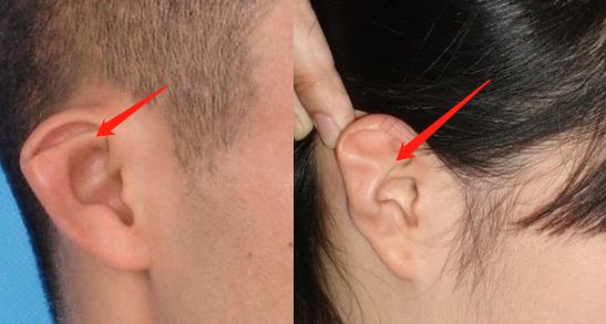 热巴最新直播自爆从小到大最自卑的颜值bug!竟然不是鼻子