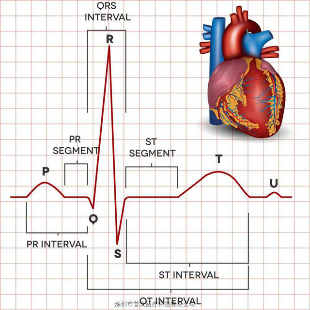 心律失常jpg