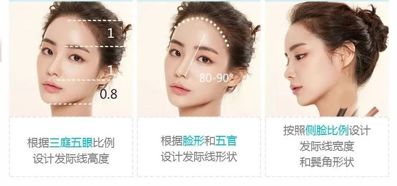 好看的发际线形状是如何打造的?_程含皛__爱问健康