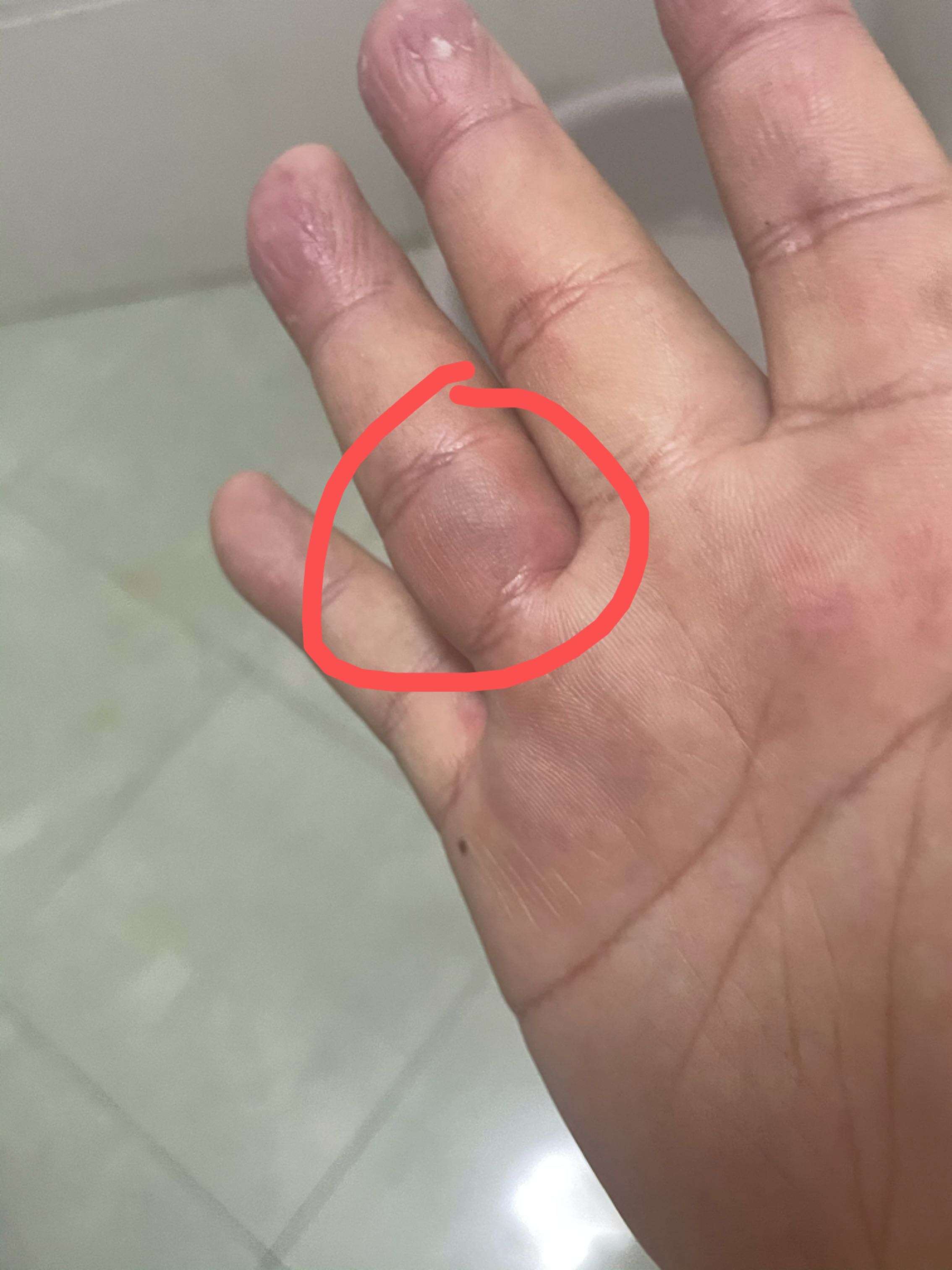 猫抓病可能_黄捷_主任医师_爱问健康