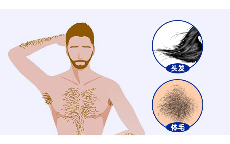 体毛植发？？？关于植发，你了解多少？_刘长春_主任医师_爱问健康