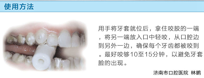 隐形矫治中咬胶的使用方法_林鹏_主治医师_爱问健康