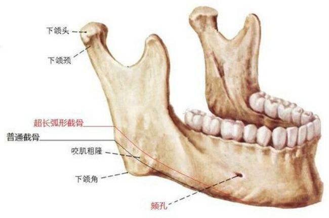 正常颊系带的位置图片图片