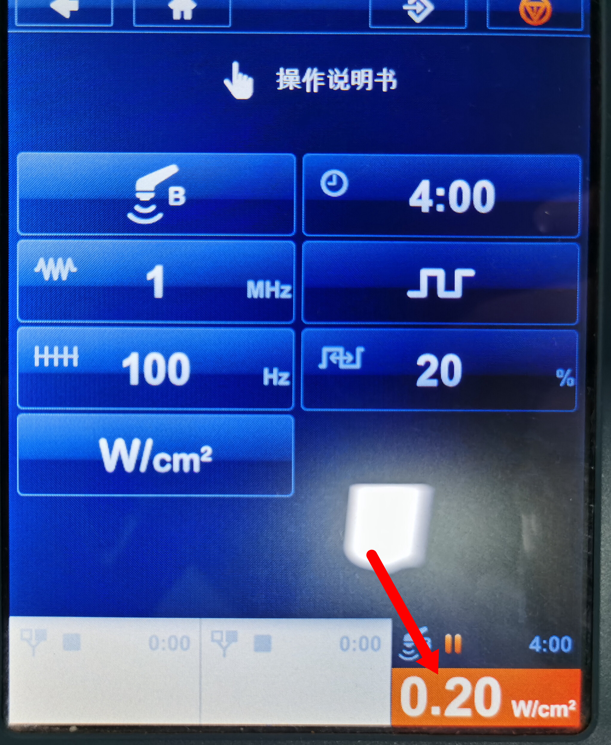 超声波治疗是什么“简单”解读超声波理疗_https://www.jmylbn.com_新闻资讯_第5张
