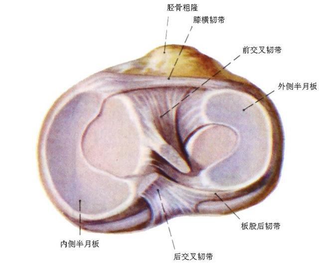 (大概是1998年前后)因追赶公交车扭伤,造成右膝关节内侧半月板撕裂,并