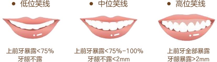 正畸美学的标准_何辉霞_主治医师_爱问健康