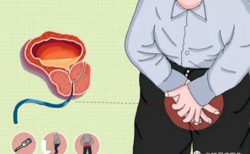 患者在被尿道口尖锐湿疣疾病所困扰之后,比较容易出现尿频,尿急,尿痛