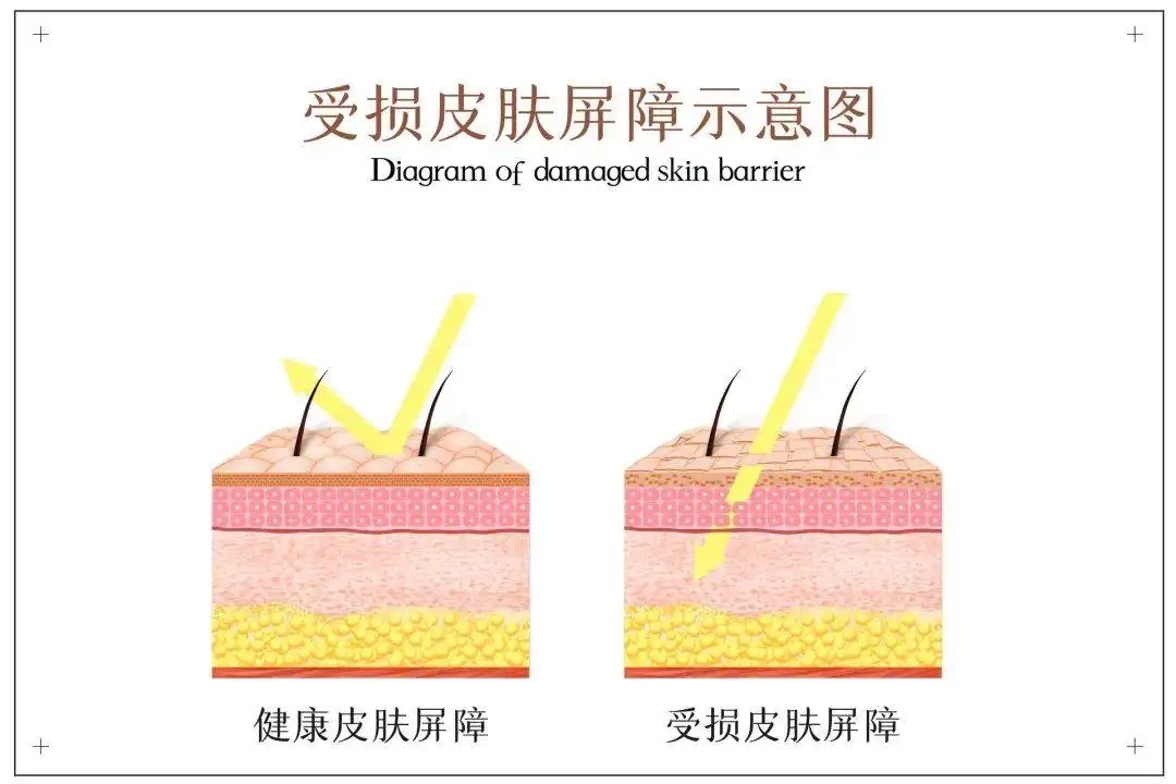 油敏肌到底该如何护肤？满分作业借你抄！_李远宏_主任医师_爱问健康