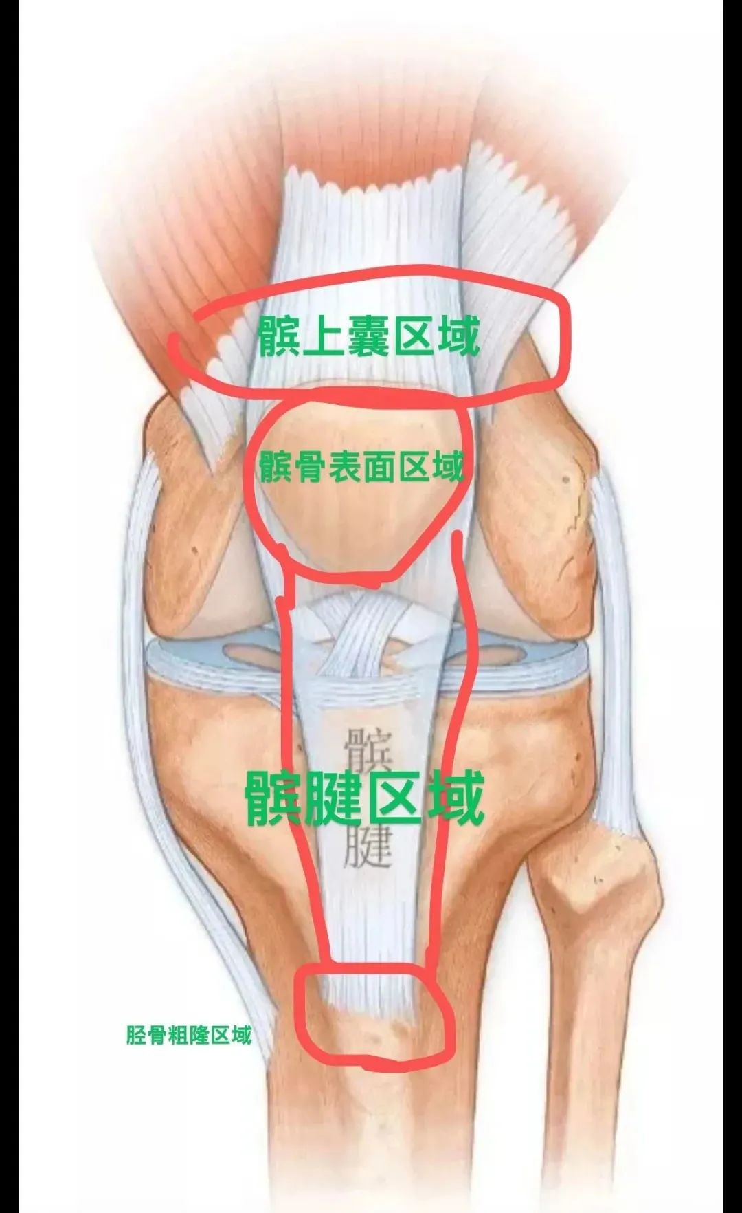 胫骨粗隆突出图片图片