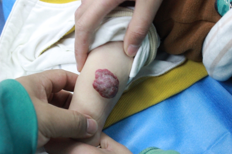 在这里汪医生也给大家提个醒,得了任何疾病一定要去正规医院检查,切勿