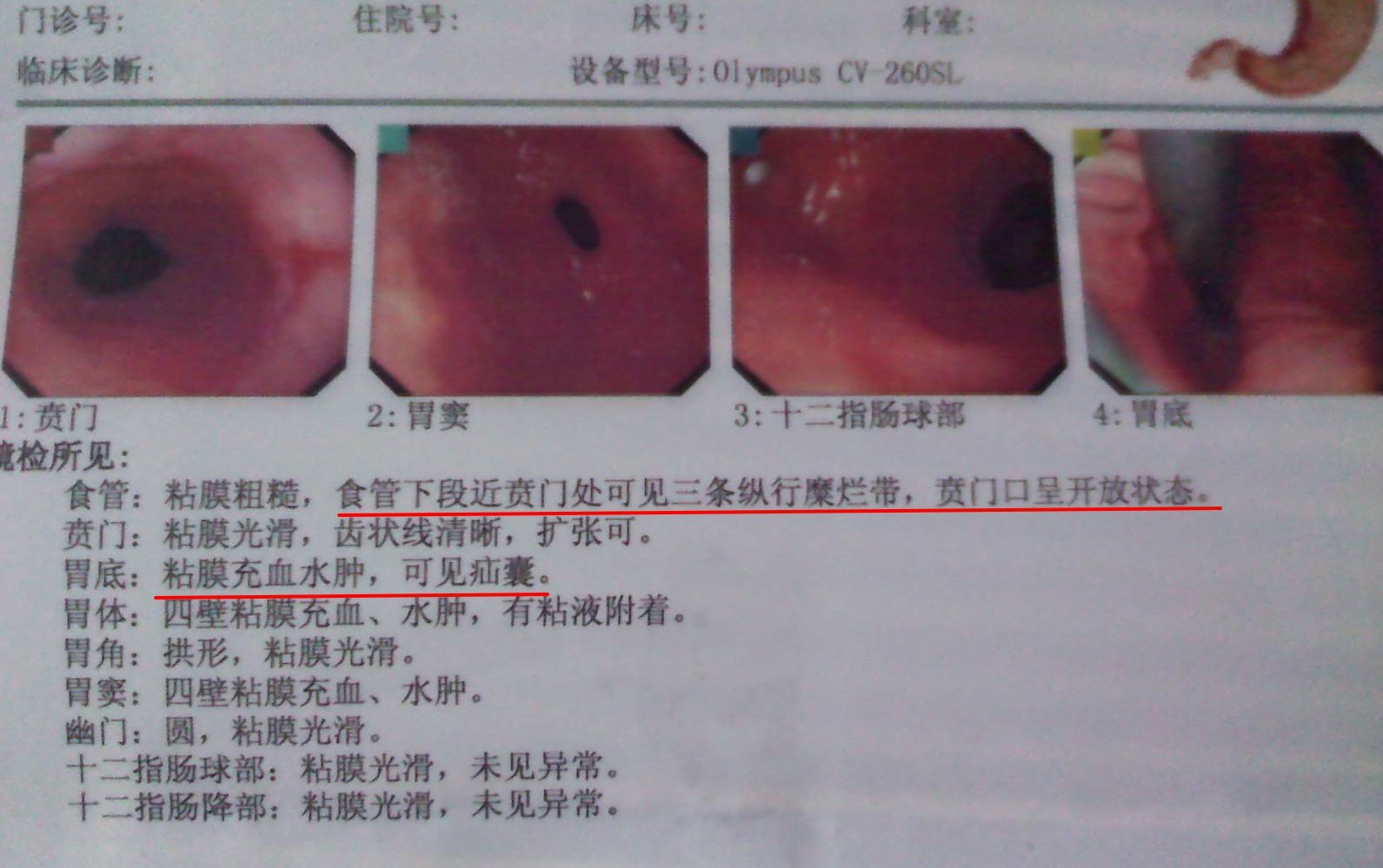胃食管反流病_管晓勇_副主任医师_爱问健康