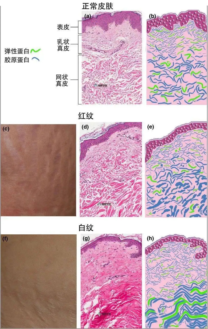 如何才能强化皮肤的美感？答案来了_李远宏_主任医师_爱问健康