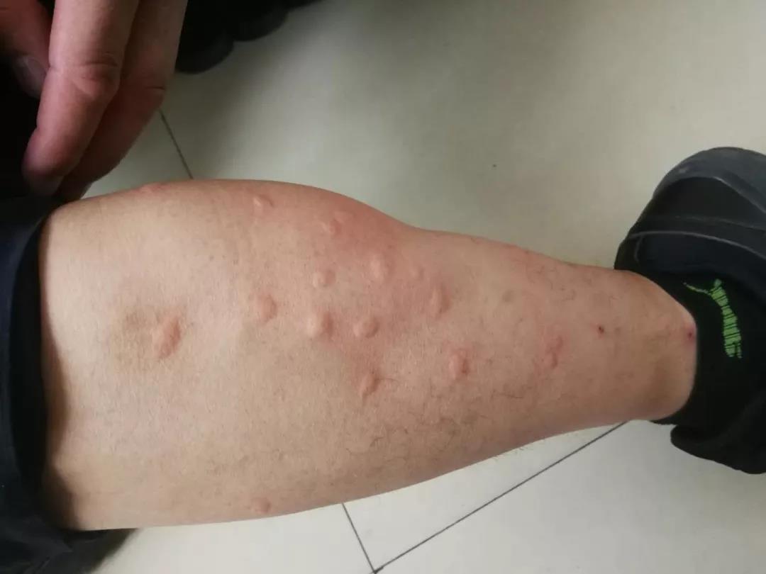 这次去杭州一家公司讲课,我随便讲了一下夏季为何蚊子只盯你?