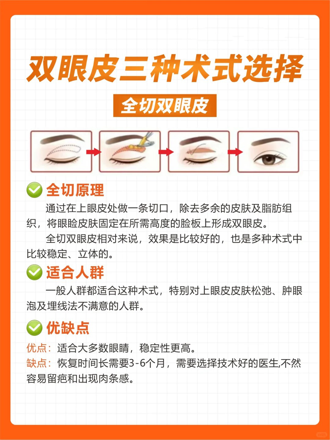 全切双眼皮的优点和缺点，你都了解吗？_刘照文_副主任医师_爱问健康